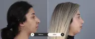 Thumbnail 17
